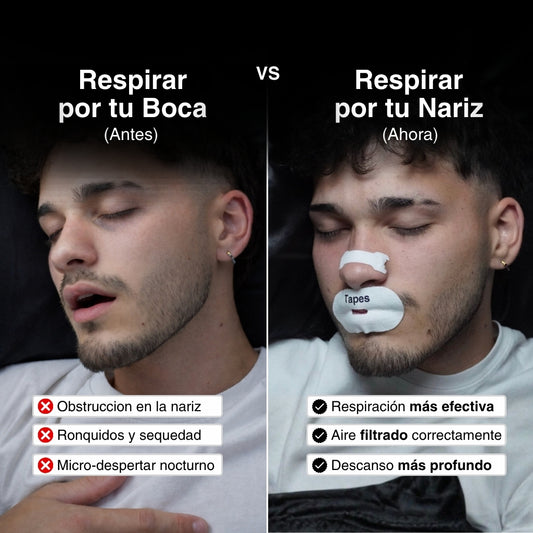 Tapes® Bucales